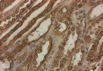 Acetyl Lysine Polyclonal Antibody HRP Conjugate