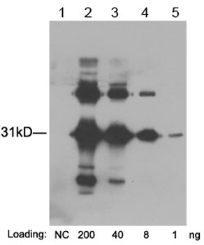 Acetyl Lysine Polyclonal Antibody-biotin Acetyl Lysine Polyclonal Antibody-biotin