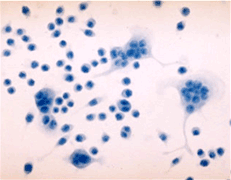 Chemokine-Like Receptor 1 Polyclonal Antibody Chemokine-Like Receptor 1 Polyclonal Antibody