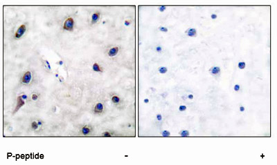 DARPP-32 (Phospho-Thr34) Polyclonal Antibody DARPP-32 (Phospho-Thr34) Polyclonal Antibody