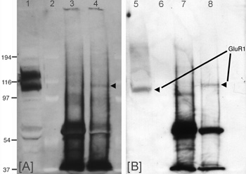 GluR1 (Phospho-Ser845) Polyclonal Antibody GluR1 (Phospho-Ser845) Polyclonal Antibody