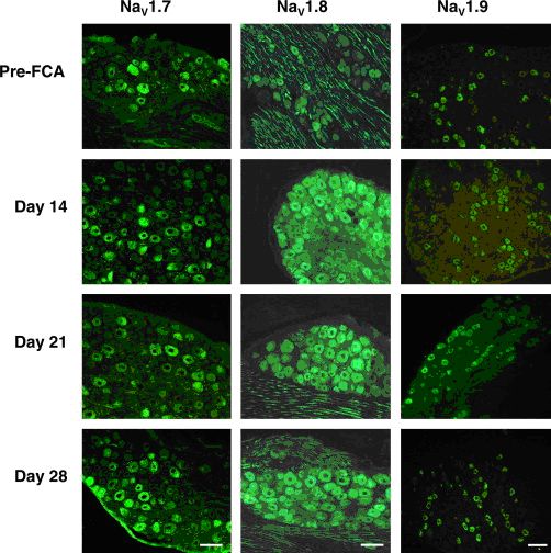 Nav1.7 Sodium Channel Monoclonal Antibody (Clone S68-6) Nav1.7 Sodium Channel Monoclonal Antibody (Clone S68-6)