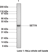 SET7/9 Polyclonal Antibody SET7/9 Polyclonal Antibody