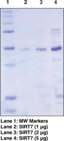 SIRT7 (human recombinant) SIRT7 (human recombinant)
