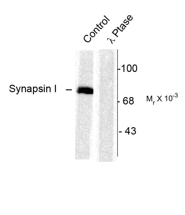 Synapsin I Polyclonal Antibody Synapsin I Polyclonal Antibody