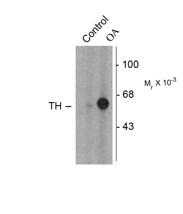Tyrosine Hydroxylase Polyclonal Antibody Tyrosine Hydroxylase Polyclonal Antibody