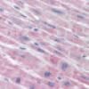 sPLA2 (human recombinant Type V)