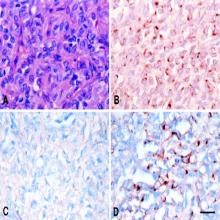 Prostaglandin D Synthase (lipocalin type; human) Western Ready Control