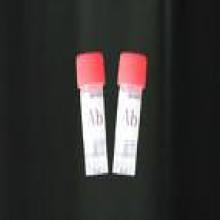 Prostaglandin D2 EIA Kit