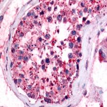 Prostaglandin E Synthase (cytosolic) Western Ready Control