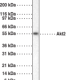 Akt2/3 Polyclonal Antibody