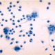 Chemokine-Like Receptor 1 Polyclonal Antibody