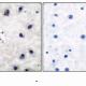 DARPP-32 (Phospho-Thr34) Polyclonal Antibody