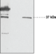 GPR55 Polyclonal Antibody