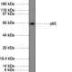NF-κB (p65) NLS Polyclonal Antibody