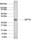 SET7/9 Polyclonal Antibody