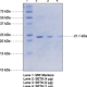 SET8 (human recombinant)