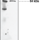 Soluble Epoxide Hydrolase Polyclonal Antibody