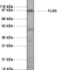 Toll-Like Receptor 5 Monoclonal Antibody (Clone 85B152.5)