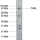 Toll-Like Receptor 6 Polyclonal Antibody