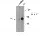 Tyrosine Hydroxylase Polyclonal Antibody